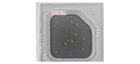 AXI-300 SiC High-Resolution Inspection Result